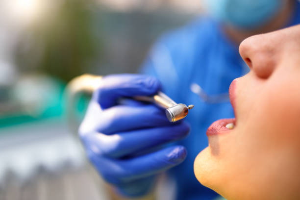 Best Veneers and Lumineers  in Marietta Alderwood, WA